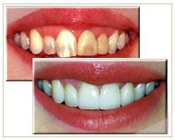 Slider image (7) Bangkok Dental Image